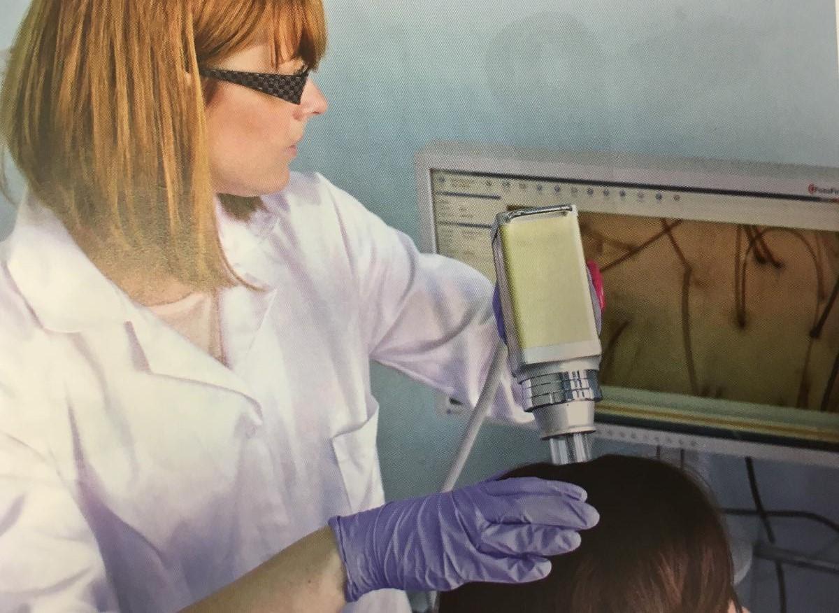 Observation des cheveux et du cuir chevelu à Istres