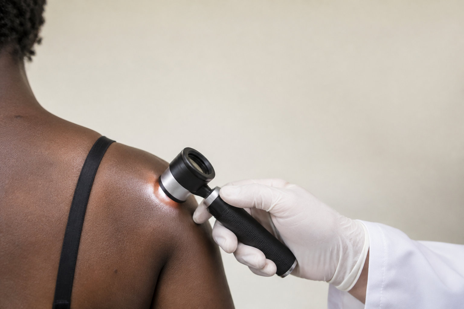 Un dermatologue examine l'épaule d'une personne à la peau foncée à l'aide d'un dermatoscope éclairé.